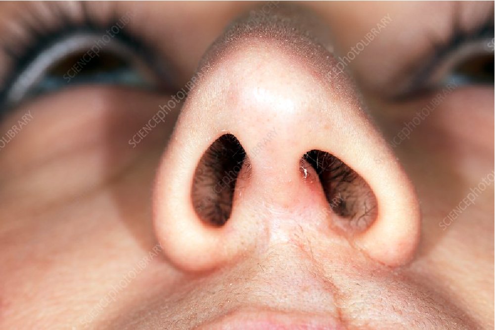 Nose job in bangalore 